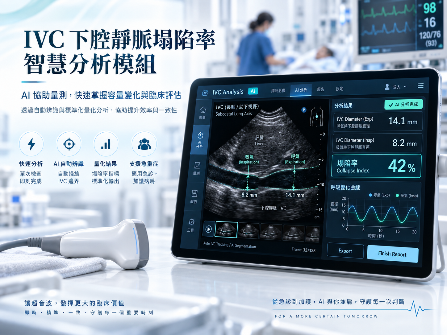 單次場域驗證-IVC 下腔靜脈塌陷率智慧分析模組